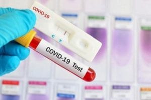 Alat Uji Covid-19 Berbasis PCR Siap Diproduksi Massal