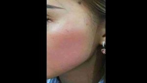 Perempuan Asal Gumuk Mas-Jember Mengaku Dianiaya Oknum Kades
