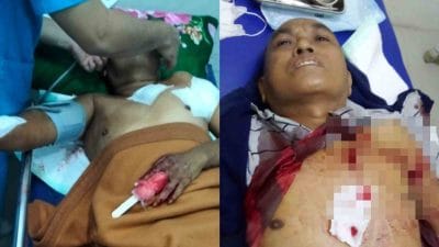 Aksi Begal Kembali Terjadi di Probolinggo, Pengemudi Ojek Online Dibacok, Motor Dirampas