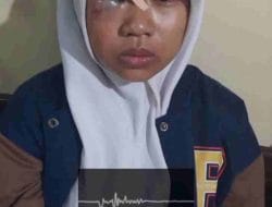 Siswi Asal Lawang Dibekap, Dipukul dan Diambil Hartanya di Pasuruan